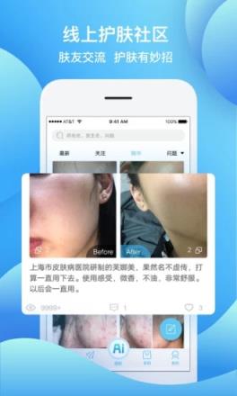 皮肤宝AI测肤护肤咨询平台