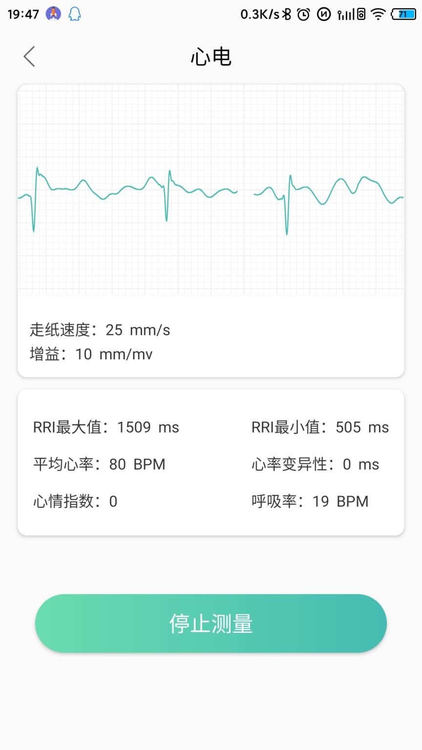 MinttiVision智能健康监护仪
