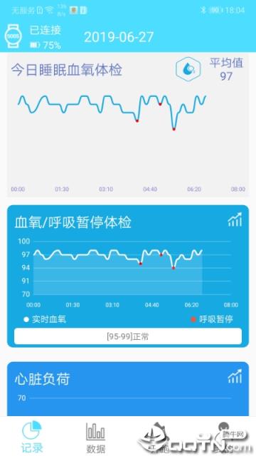盖德手环