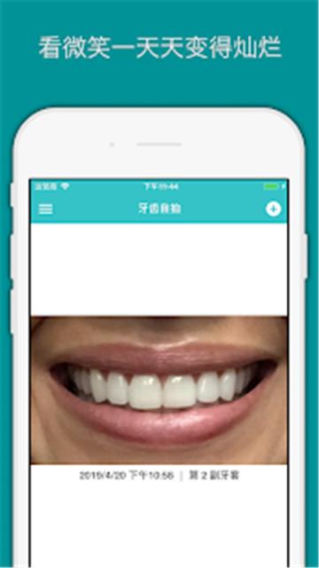 TrayMinder牙套记录app
