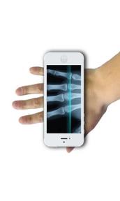 手机X光拍片软件