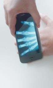 手机X光拍片软件下载