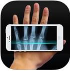 透析x计划最新版