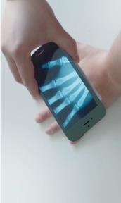 透析x计划软件安卓版