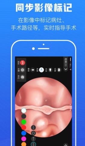 远程手术协作APP