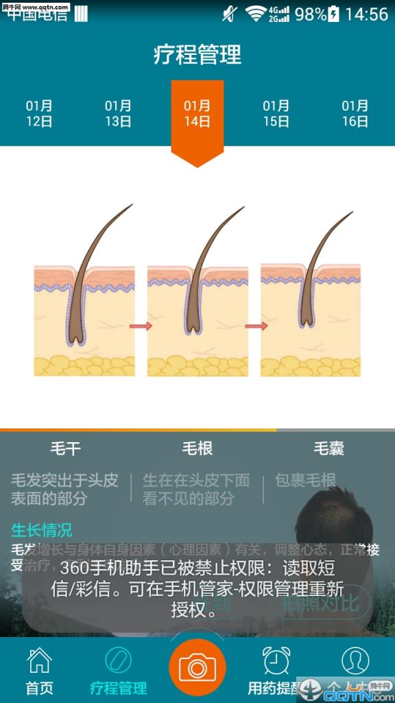 脱发管家APP官方