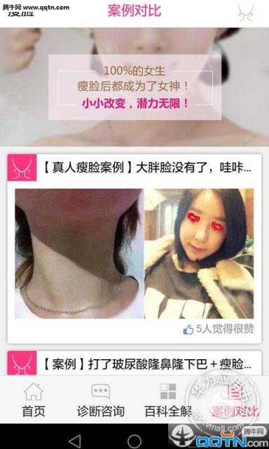 瘦脸APP安卓手机