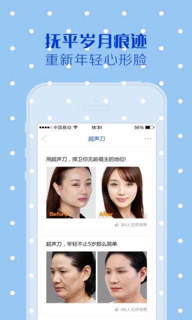 超声刀安卓版