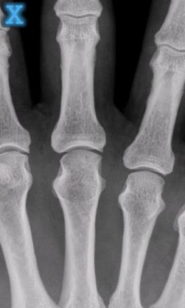 手机透视骨骼软件