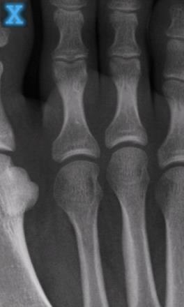 手机透视骨骼软件