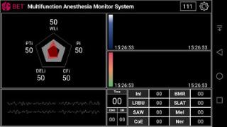 麻醉全深度监护仪