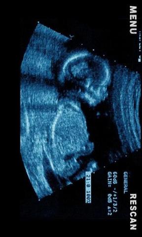 B超手机扫描恶搞软件官方下载